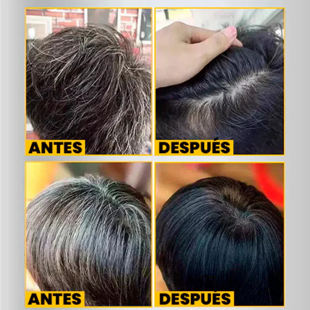 SHAMPOO CUBRE CANA DR. RASHEL® ORIGINAL (EN 10 SACHETS DE 25ML C/U)